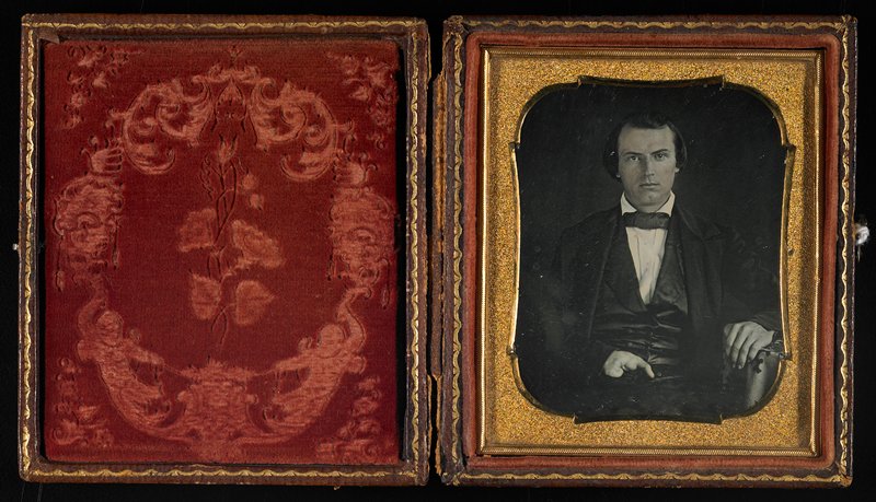 Untitled [man with defective hand], c. 1850
