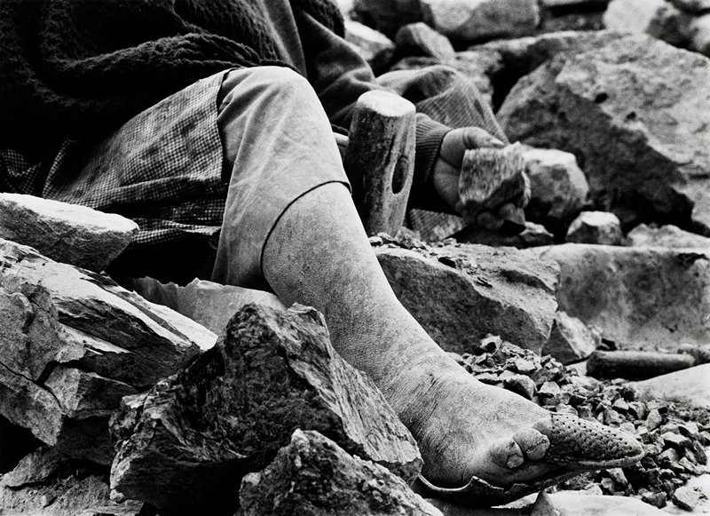 Bolivia Mineros, Llallagna Siglo XX Cancañin [leg and foot], Jean-Claude Wicky, 1991