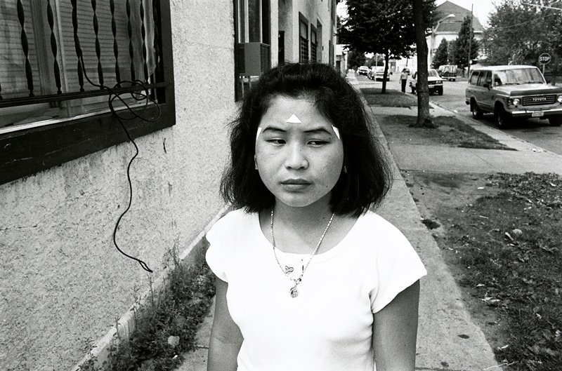 Girl with Medicinal Triangles, Frogtown, Wing Young Huie, 1994