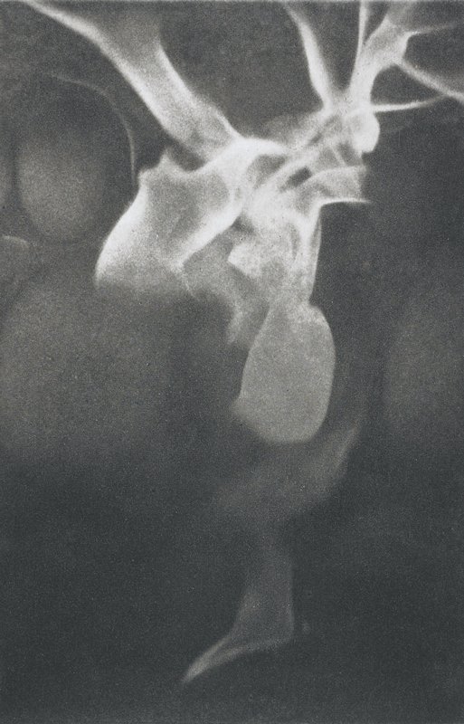 Pyre VI, Bernice Ficek-Swenson, 2001–2006