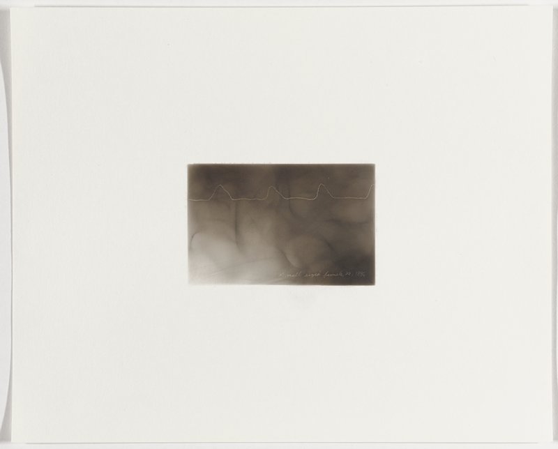 Small sized female, 28, 1886, Plate 3 from The First Time, The Heart (A Portrait of Life 1854-1913), Dario Robleto, 2017