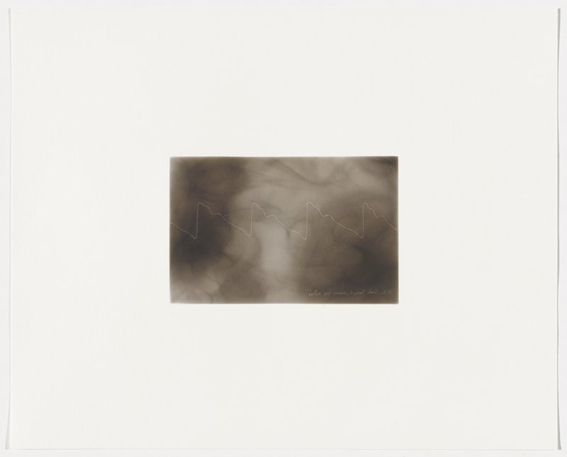 Pulse of a man, 6 feet tall, 1870, Plate 4 from The First Time, The Heart (A Portrait of Life 1854-1913), Dario Robleto, 2017
