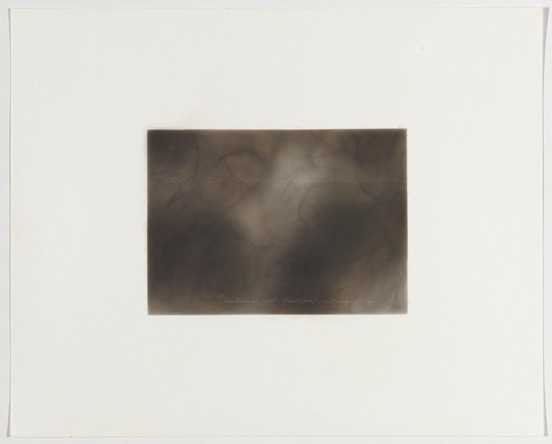 Umbilical cord, first gasp, cutting of cord, 1886, Plate 9 from The First Time, The Heart (A Portrait of Life 1854-1913), Dario Robleto, 2017