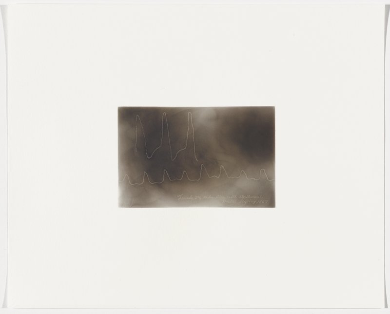 Female, 24, exhaustion with excitement, pulse leaping, 1867, Plate 10 from The First Time, The Heart (A Portrait of Life 1854-1913), Dario Robleto, 2017