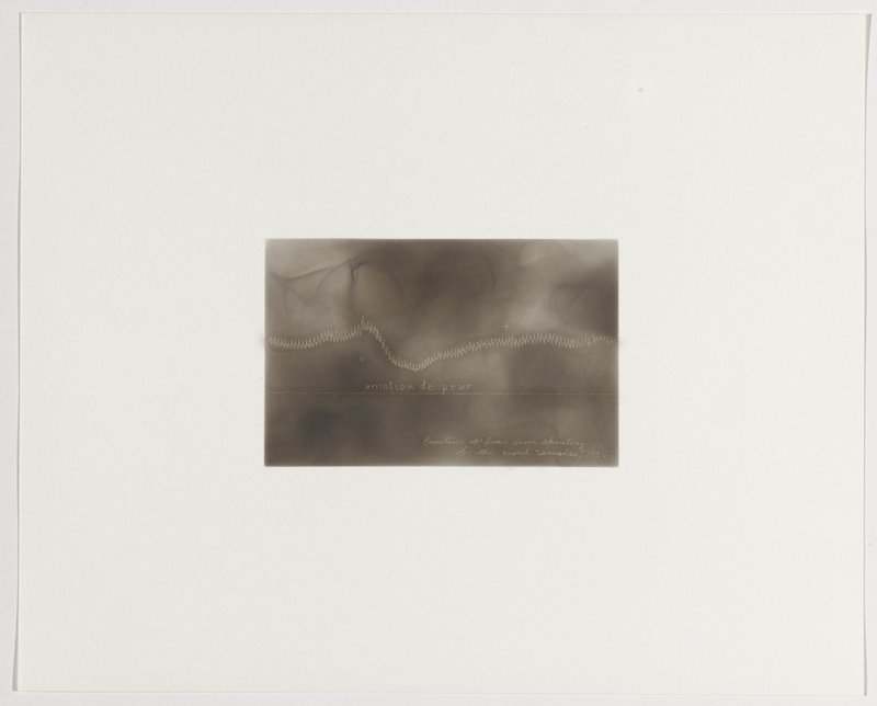 Emotion of fear from shouting of the word snakes, 1896, Plate 18 from The First Time, The Heart (A Portrait of Life 1854-1913), Dario Robleto, 2017