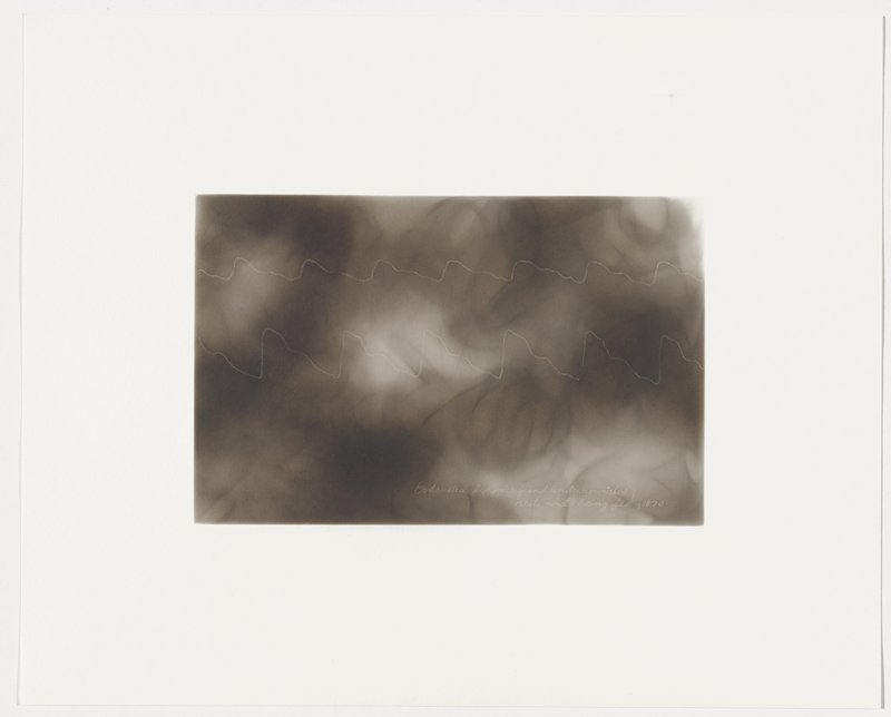 Exhausted by misery and undernourished; rest and being fed, 1870, Plate 21 from The First Time, The Heart (A Portrait of Life 1854-1913), Dario Robleto, 2017