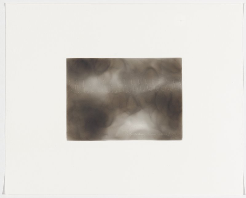 Palpitations (panic attack), 1902, Plate 30 from The First Time, The Heart (A Portrait of Life 1854-1913), Dario Robleto, 2017