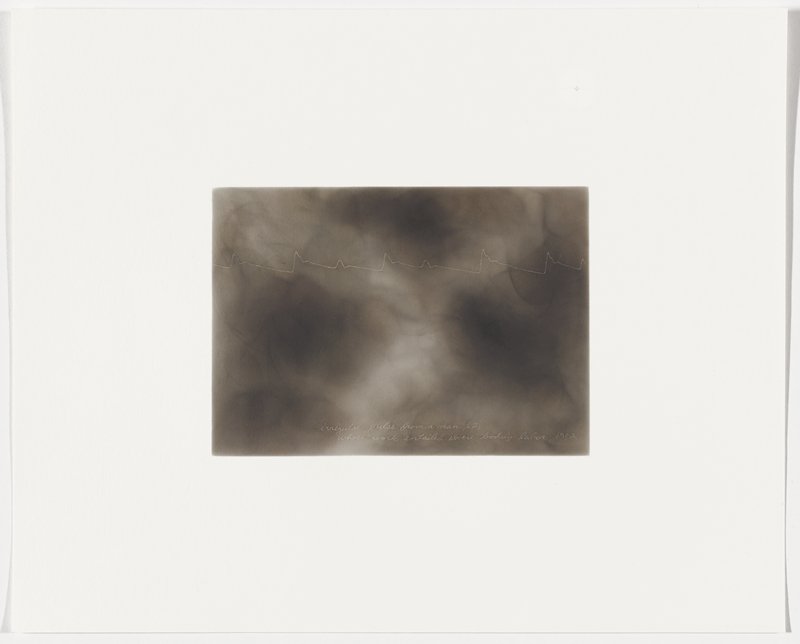 Irregular pulse from a man, 62, whose work entailed severe bodily labor, 1902, Plate 43 from The First Time, The Heart (A Portrait of Life 1854-1913), Dario Robleto, 2017