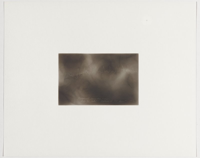 Quickened irregular pulse due to sudden failure of the heart, 1902, Plate 48 from The First Time, The Heart (A Portrait of Life 1854-1913), Dario Robleto, 2017