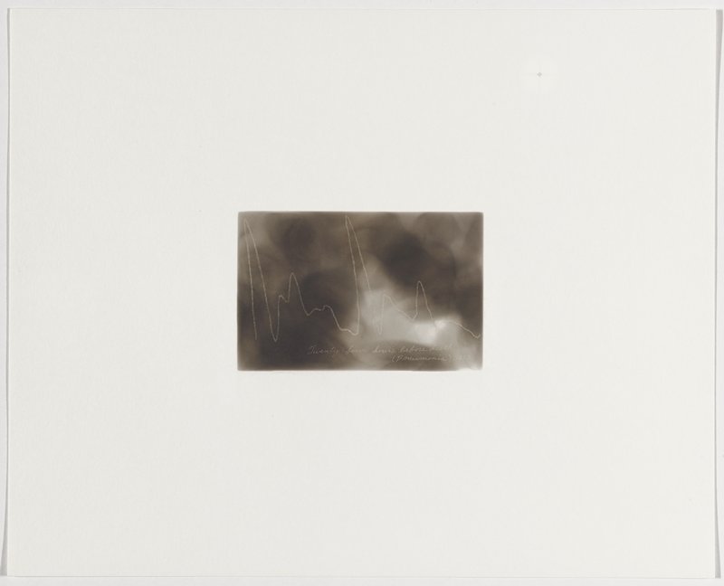 Twenty-four hours before death, (pneumonia), 1883, Plate 49 from The First Time, The Heart (A Portrait of Life 1854-1913), Dario Robleto, 2017