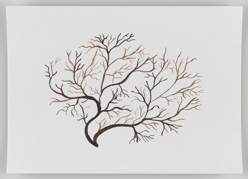 Meningeal Arteries, from Echo #3, Rafael Villares, 2015–19