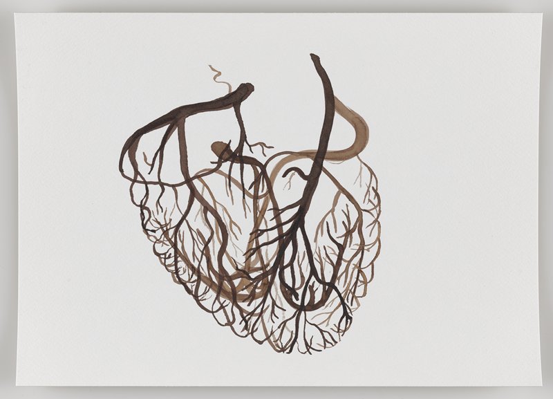 Arteries and Veins of the Heart, from Echo #3, Rafael Villares, 2015–19