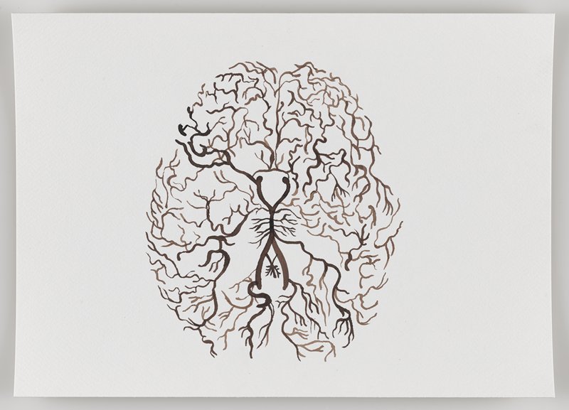 Cerebral Arteries, from Echo #3, Rafael Villares, 2015–19
